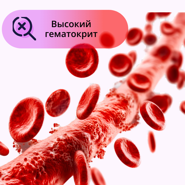 Высокий гематокрит Высокий гематокрит