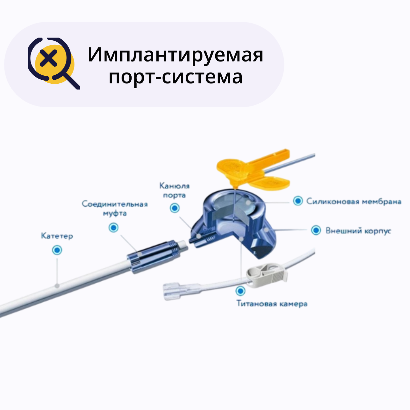Промывка имплантируемой порт-системы